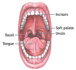 Tonsillectomy in children